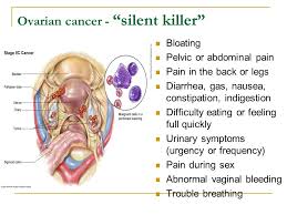 Other less common ovarian cancer symptoms may include, pain during sexual intercourse. Precancer Diseases Of The Female Sexual Organs Female Cancer Ppt Video Online Download
