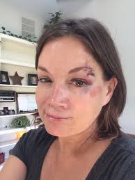 Beverly Kidd's epic bike wipeout