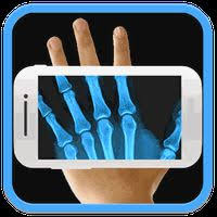 Sometimes it's on the apron already, but doctor's simply don't flip it up to cover your neck. X Ray Scanner Apk Free Download For Android