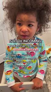 Image result for Absence Seizure