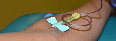 Now, using one hand, extend the leg on the bottom, apply a small amount of alcohol and carefully identify the vein. Butterfly Venipuncture