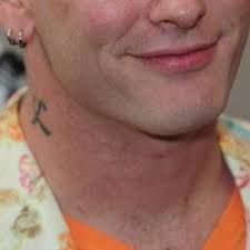 I did that last year and got the approval in 12 days or so (applied in premium). Corey Taylor S Neck Treetrunkneck Twitter