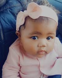 Conjoined twins separated. Don't...