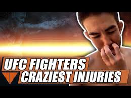 Jared cannonier talked about his injury, his plans and his past. Pic Jared Cannonier Breaks Arm At Ufc 254 Vs Robert Whittaker Fightful News