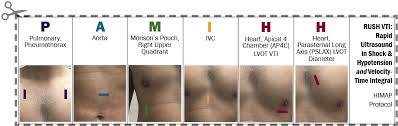 Work on this for 2 days before an exam. Rush Vti Emlrc Lifesaving Education For Lifesavers