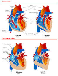 Image result for Tet Spell