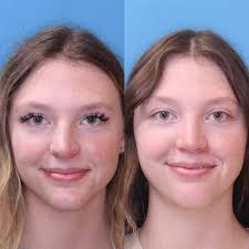 Facial Plastics happy hour with Dr Greg Branham of @washu.ent. We discuss  interesting cases…but mostly we retell some unforgettable stories!