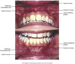 Image result for Labial mucosa