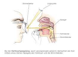 Stimmbandpolypen Polypen Der Stimmbander Eesom Gesundheitsportal