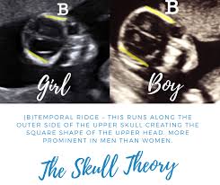 The Skull Theory Boy Or Girl Prediction Baby Gender Ultrasound Ultrasound Gender Ultrasound Gender Prediction
