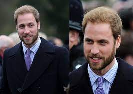 Sekret szczupłej sylwetki kate middleton. Jeszcze 10 Lat Temu Ksiaze William Wygladal Jak Przystojniak Z Okladki Z Broda Mu Do Twarzy