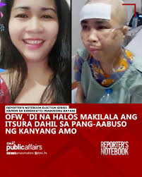 Pinapaso at pinupukpok ang OFW na si Leslie Diaz ng kanyang amo sa Saudi  Arabia. Mga peklat sa iba't-ibang bahagi ng katawan at mga paso ng plantsa  sa braso at kamay rin