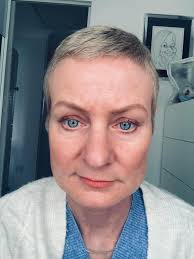 Hair growth after breast cancer chemotherapy