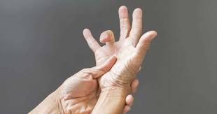 Image result for Trigger Finger