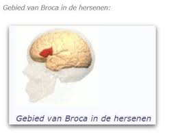 Afasie is een taalstoornis als gevolg van een hersenbeschadiging bij mensen die voorheen geen wanneer iemand afasie heeft, kan het voor hem of haar moeilijk zijn om op woorden te komen. Afasie Expressieve Vorm Taal En Spraakproblemen Niet Zichtbare Gevolgen Gevolgen Hersenletsel Uitleg Nl