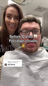Replying to @Haley &' Myron Wilson hubbys teeth prepped for porcelain  crowns