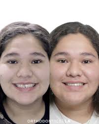 Orthodontics LA