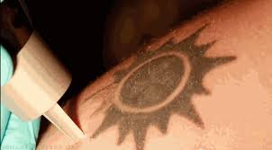 Good tattoos do not come cheap, but the idea of a regular wage varies hugely. Here S What Really Happens When You Remove A Tattoo With Lasers