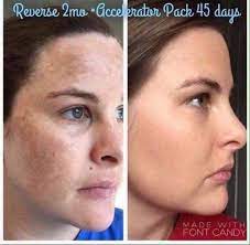 Check Out Her Glow And Her Exact Words I Am So Thankful That I Said Yes To Rodan Fields 3 1 2 Rodan And Fields My Rodan And Fields Rodan And Fields Reverse