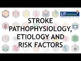 Image result for Stroke Pathophysiology
