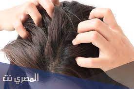 سبب حكة فروة الراس وعلاقتها بتساقط الشعر المصري نت