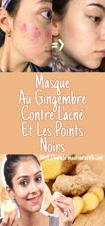 Pin On Astuces Beaute