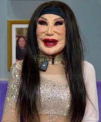 Lyn May's Tragic Journey Through Fame And Cosmetic Surgery: She was a  famous actress who appeared in around 100 movies, but one tragic mistake  completely ruined her appearance. Many people are shocked
