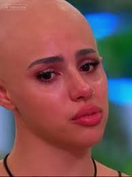 Ayo Bald Love Island