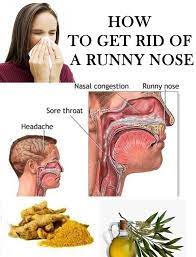 Natural Remedies To Get Rid Of Runny Nose Nasal Congestion Cold Symptoms Treatment For Sore Throat