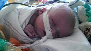 Herz War Viel Zu Gross Baby Nach Zehn Stunden Op Gerettet