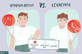 Blood tests show how well your kidneys are working. Leukemia Coping Support And Living Well
