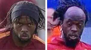 L'attaccante della roma gervinho ha mostrato la sua vera capigliatura perdendo la fascia che usa portare intorno alla testa durante un incontro. Gervinho Perde La Fascia E Mostra La Calvizie Twitter Si Scatena Cercasi Parrucchiere Il Mattino It