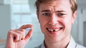 Image result for Tooth Avulsion