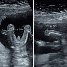 The Nub Theory - The Earliest, Accurate Way Of Finding Out Gender?