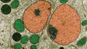 A person who does not undergo testing may have a heart attack without warning, because they did not in the past, people have aimed to reduce cholesterol to a target level, for instance, below 100. Crispr Base Editing Slashes Cholesterol Levels In Monkeys Stat