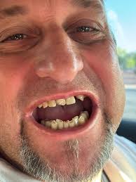 Bionic Smile Fan Club