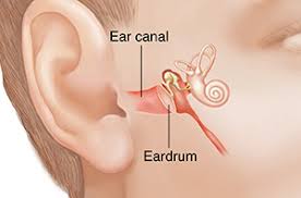 What causes ears to plug up. Impacted Earwax