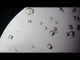 All forms are colorless or white. Cristaux D Oxalate Calcium Urine Ecbu Youtube