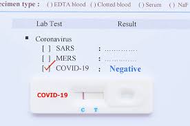 Tes Covid 19 Sebelum Naik Pesawat Pilih Swab Antigen Atau Pcr