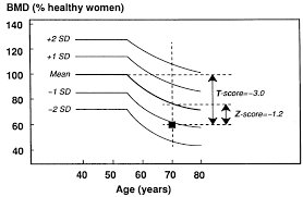 Assessment Of Bone Mineral Density In A 70 Year Old Woman