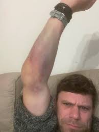 Moin moin zusammen, Hat jemand Erfahrung wie breit ein 35er Continental  gp5000 all Season bei 24er Maulweite wird?? Danke für eure Hilfe!