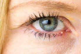 Behandlungsmoglichkeiten Gegen Gerstenkorn Am Auge Hordeolum