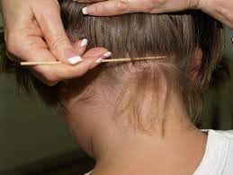 Lice Removal Clinics San Diego California Lice Clinics Of America In San Diego