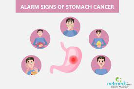 In general, the more advanced the cancer (the more it has grown and spread). Gastric Cancer Causes Symptoms And Treatment Netmeds