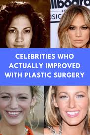 Celebrities Who Actually Improved With Plastic Surgery Plastic Surgery Quotes Plastic Surgery Celebrities