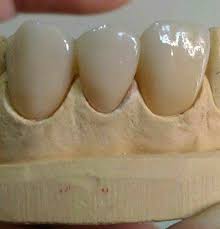 Vacancies in engineering and technical services in malaysia. Dental Lab Job Vacancy Malaysia Posts Facebook