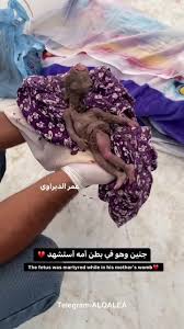 Palestinian fetus killed by Israeli missile - LiveGore.com
