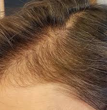 100% safe and guaranteed · up to 80% off · trusted since 1997 Thick Hair Vs Thin Hair And What Are Their Key Differences