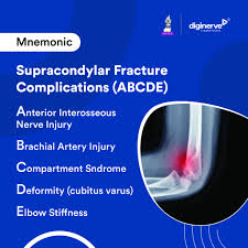 Image result for Fracture Complication