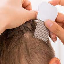 Ensure that no part of the hair is left untouched. How To Get Rid Of Head Lice Best Natural Head Lice Remedies